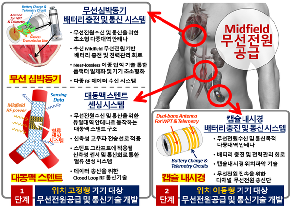 인체 삽입형 초소형 의료기기(사진=과학기술정보통신부)