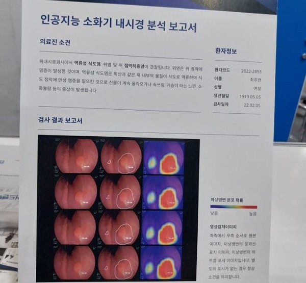AI를 접목, 이상병변 부위가 발견되면 ROI를 이용하여 특정하는 인공지능 내시경 기술.