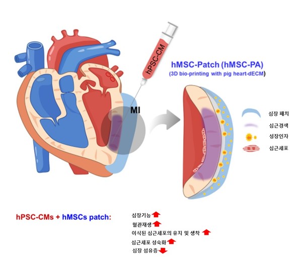 줄기세포 기술을 활용한 심근경색치료법이 개념도로서, 본문 기사와는 직접 관련이 없음. (출처=건국대학교)