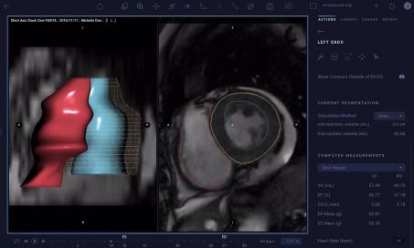아터리스사의 영상 판독 화면. (출처=아터리스사, 김규훈 코난테크놀로지 그룹장)