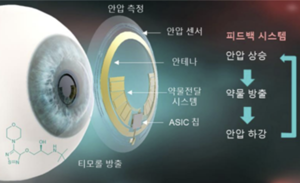 개발 중인 녹내장 진단 치료 스마트 콘택트렌즈(사진:과학기술정보통신부)