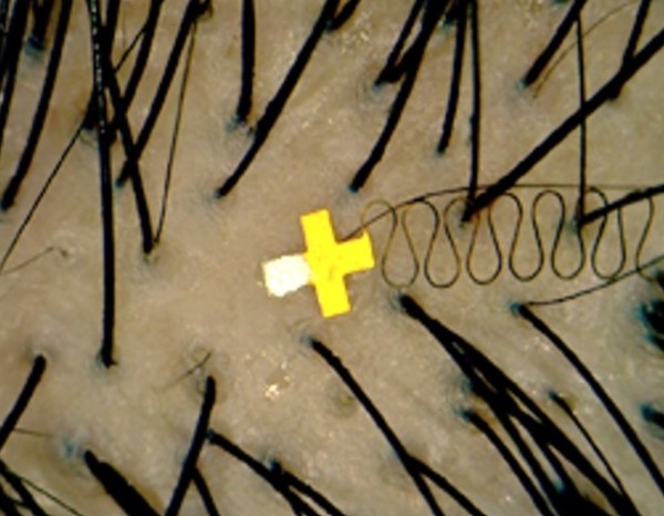 머리칼 모낭에 부착할 수 있는 초소형 뇌 센서 이미지. (출처=미 국립과학원)